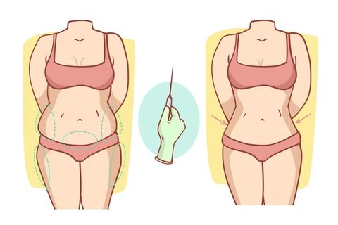 Liposuction for Belly Fat: A Beginner’s Guide to Procedure, Benefits, and Recovery